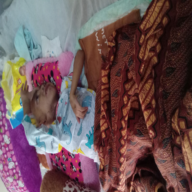 Mengindap Kanker Ganas Ewing Sarcoma (Kanker Tulang)