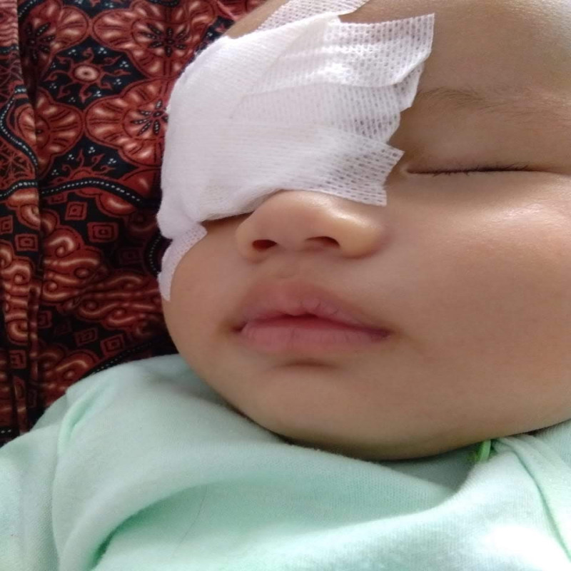 Lahir Tanpa Lensa Mata, bantu Shakel untuk Sembuh