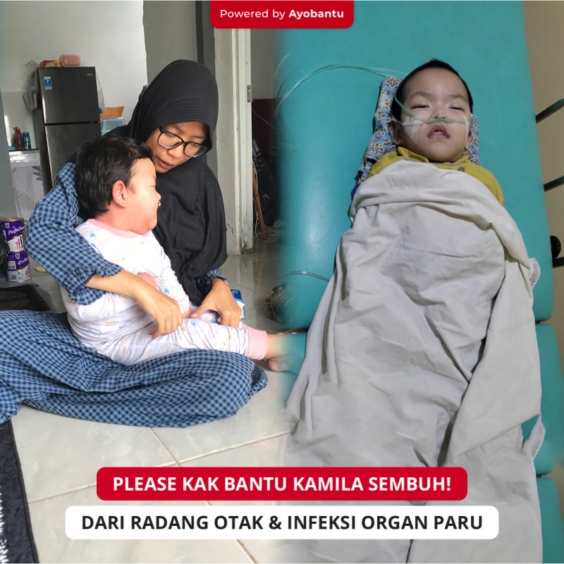 Radang Otak dan Infeksi Organ Paru, Ayo Bantu Kamilah Sembuh