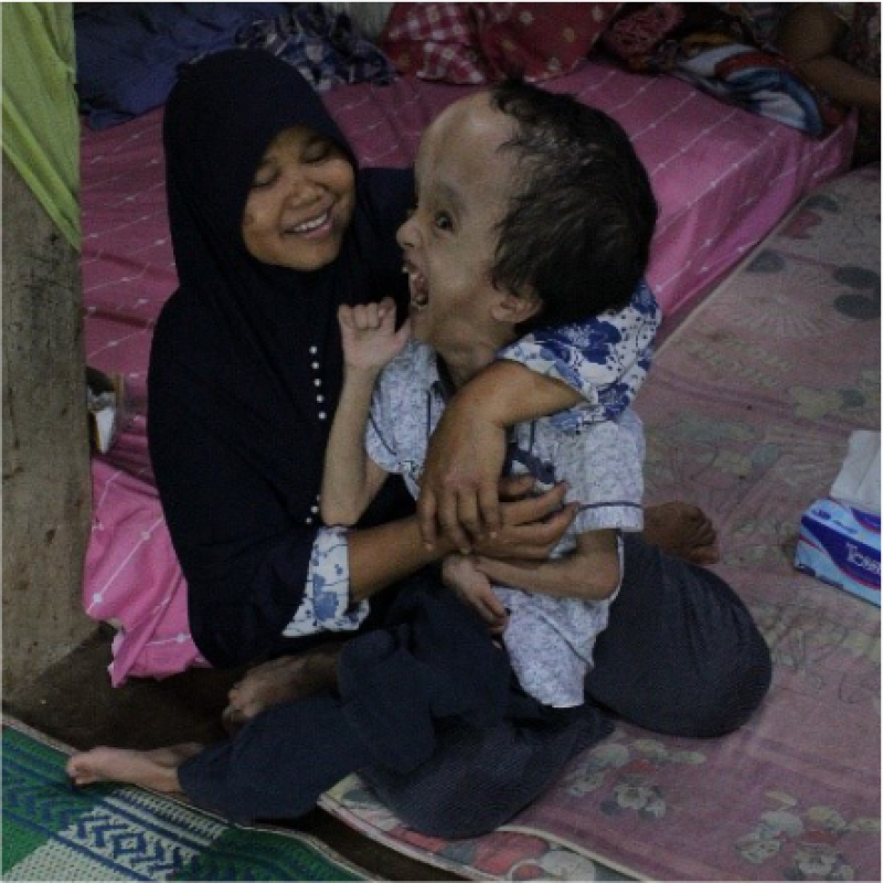 Bantu Modal Usaha dan Biaya Kontrol Kesehatan Penderita Hidrosefalus