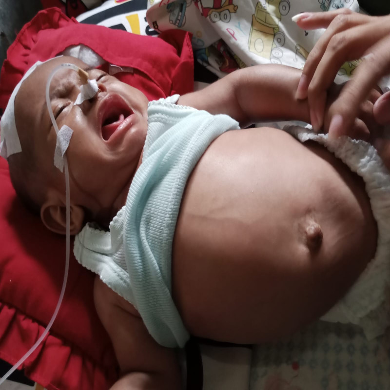 Urgent!!! Bayi fatih harus segera operasi kepala