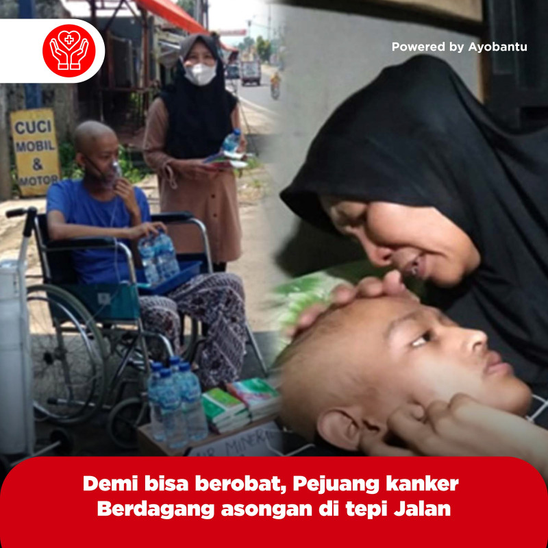 Demi bisa Berobat, Pejuang Kanker Berdagang Asongan di Tepi Jalan
