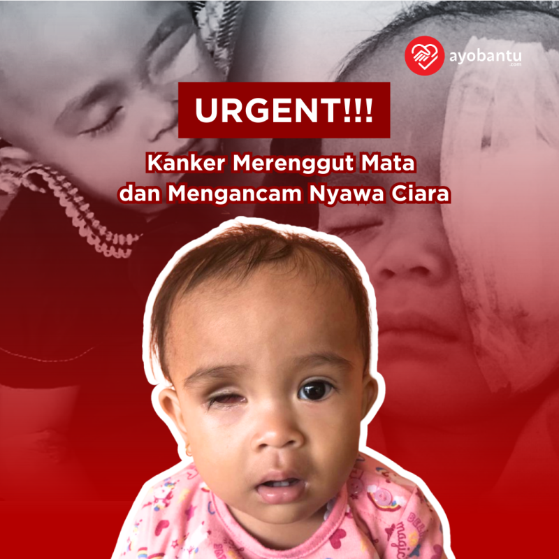Kanker Merenggut Mata dan Mengancam Nyawa, Tolong Ciara!