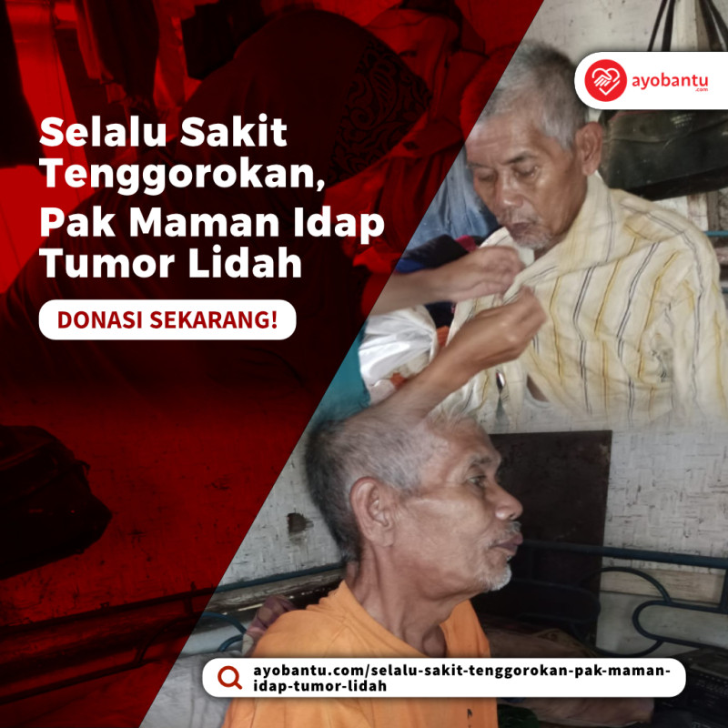 Selalu Sakit Tenggorokan Pak Maman Idap Tumor Lidah