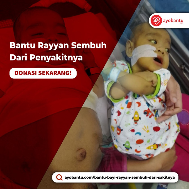 Bantu Bayi Rayyan Sembuh Dari Sakitnya