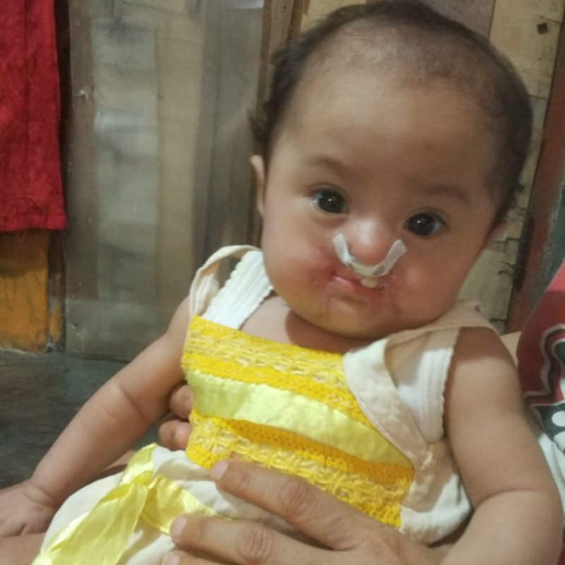 Bantu Pengobatan Rumaisha Sampai Sembuh