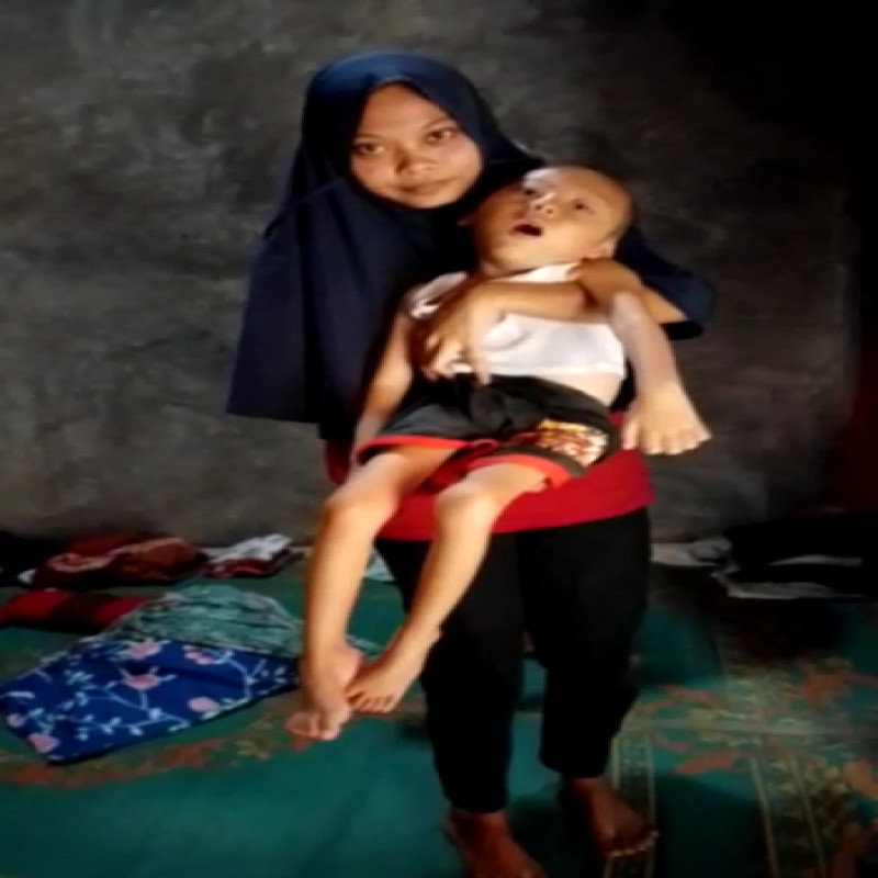 Anak Yatim Lumpuh Otak Tidak Bisa Berobat