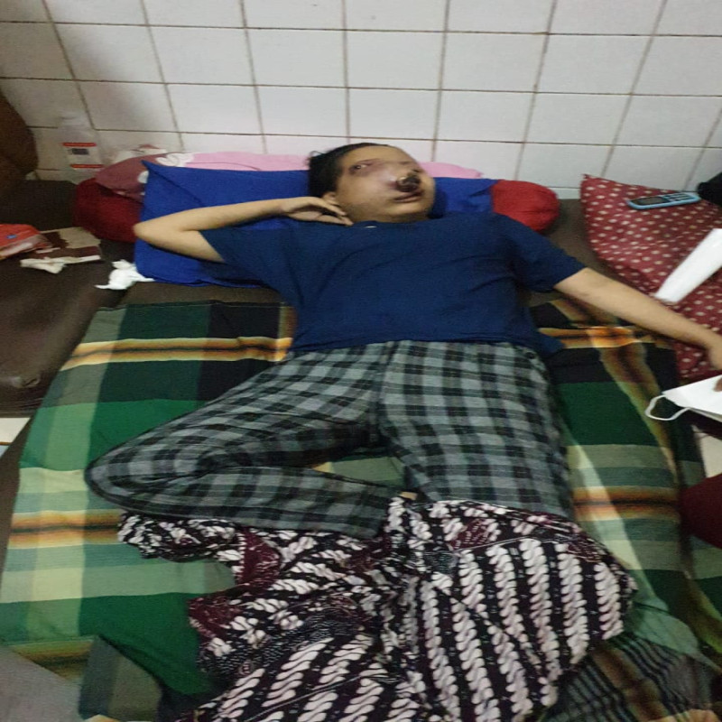 Kuatkan Perjuangan Nurcahyanik Melawan Tumor Ganas yang Mengancam Nyawanya