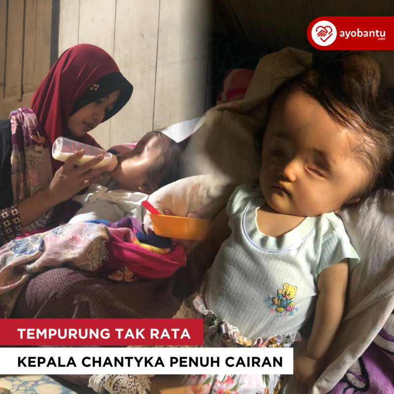 Tempurung Tak Rata, Kepala Canthyka Penuh Cairan