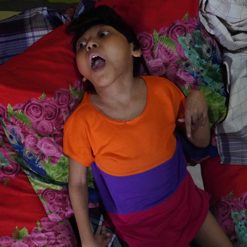 Tubuh Kaku Bertahun-Tahun, Bantu Adik Hana Sembuh Dari Epilepsi