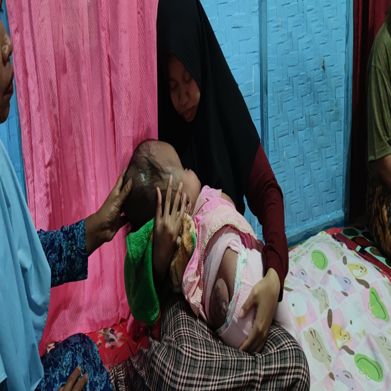 Bantu Bayi Mungil Berjuang Lawan Hidrosefalus