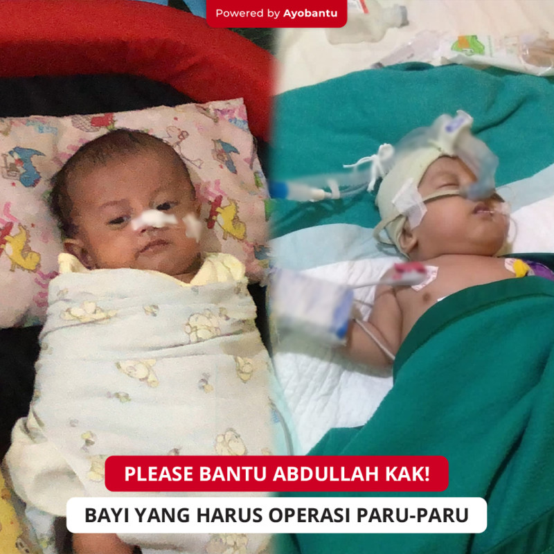 Bantu Abdullah, Bayi 4Th OPERASI PARU-PARU