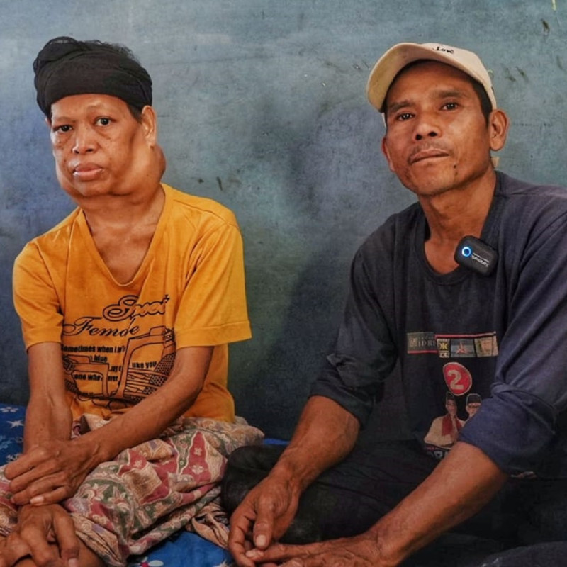 Bantu Ibu Yoyoh Sembuh dari Tumor Getah Bening