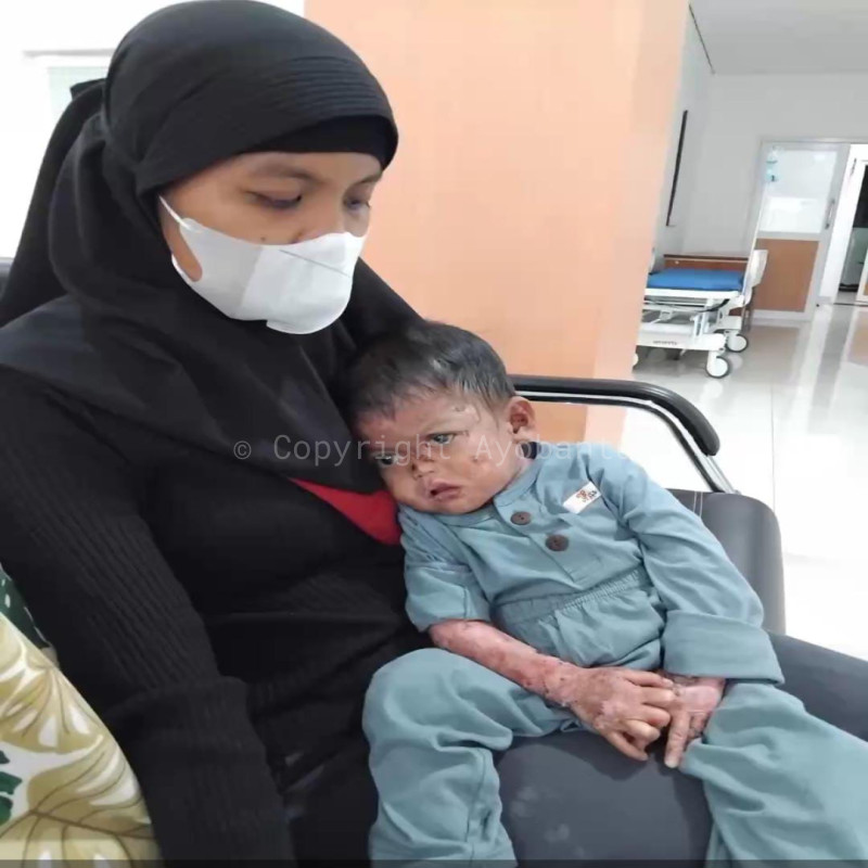 Bantu Bu Ningsih dan Adik Dava Sembuh dari Penyakitnya!