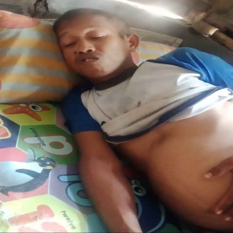 bantu ajon melawan penyakit tumor