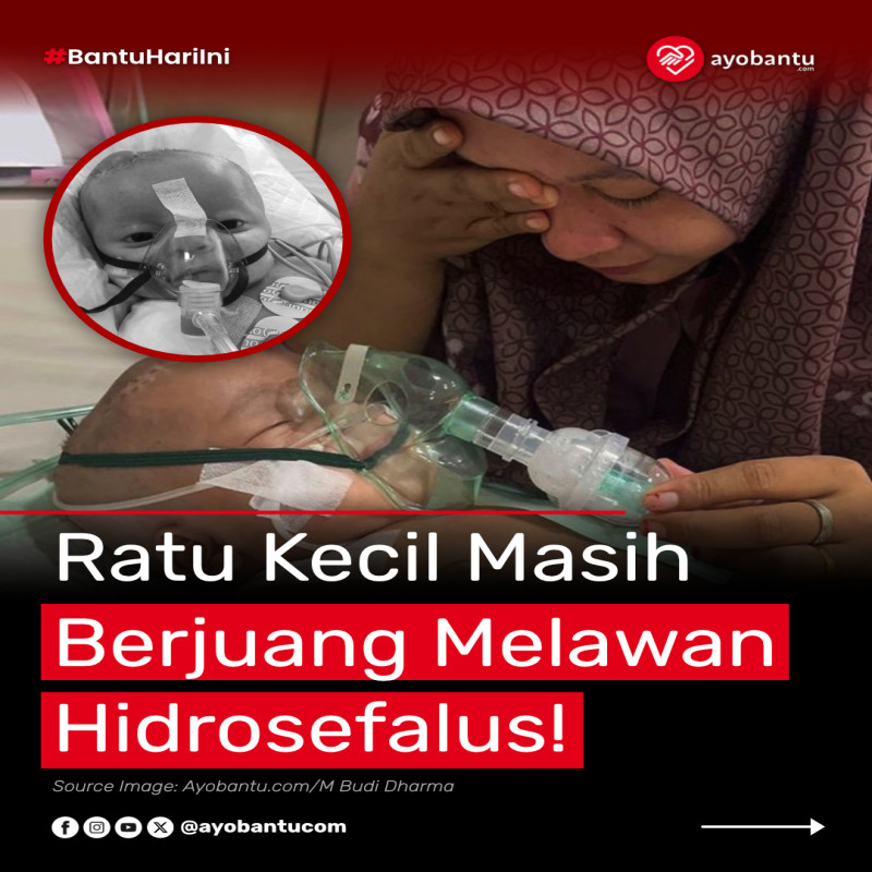 Selamatkan Ratu dari Hidrosefalus