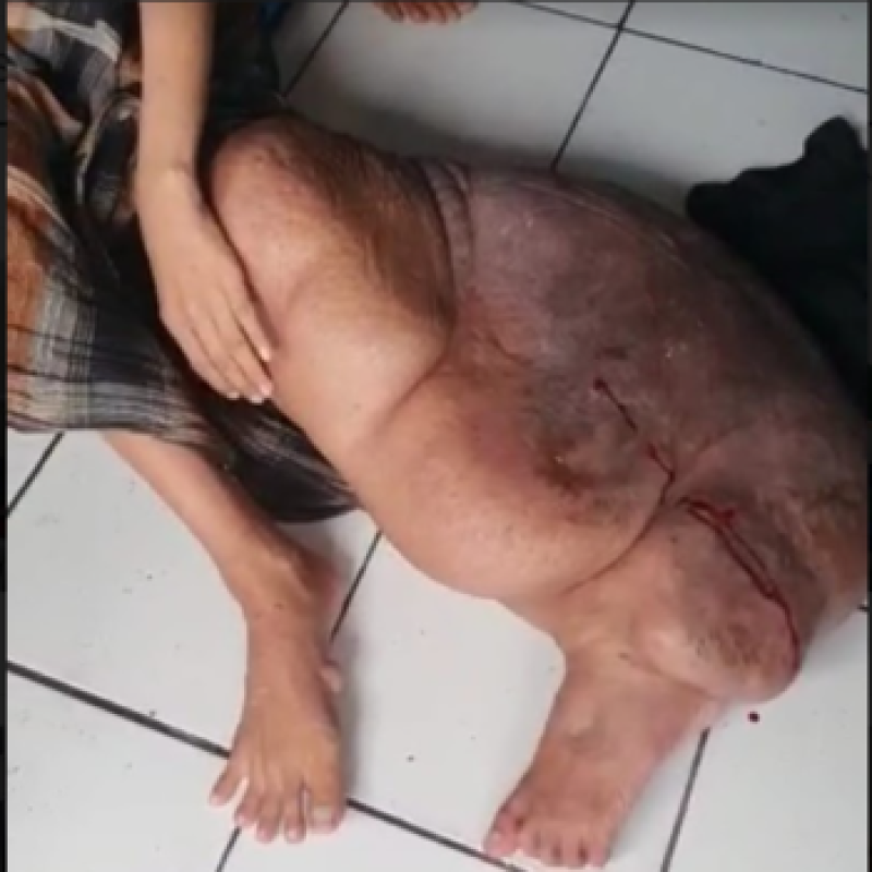 Sudah 16 tahun lamanya, Wahyu (24 tahun) dengan sabar menanti kesembuhannya.