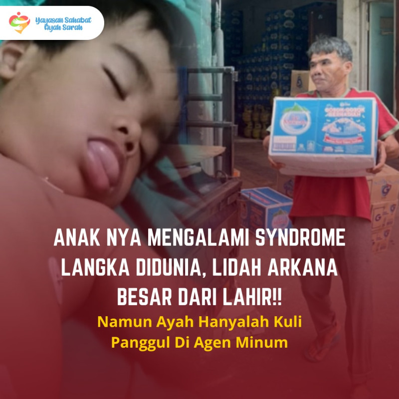 Lidah Menjulur Keluar Bantu Anak Tukang Panggul Sembuh!