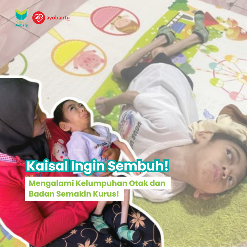 otak lumpuh badan kurus, Kaisal Kecil ingin sembuh!