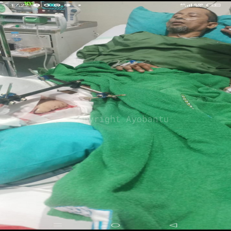 Menjadi korban tabrak lari Driver Gojek berjuang melawan PATAH KAKI kanan.
