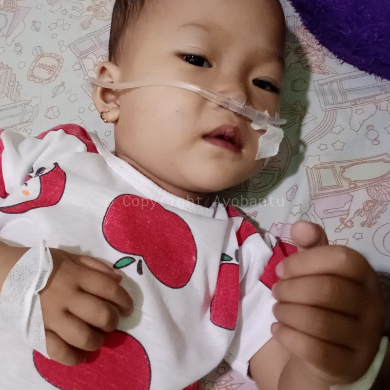 URGENT DAVIENA HARUS SEGERA OPERASI JANTUNG DAN PARU PARU