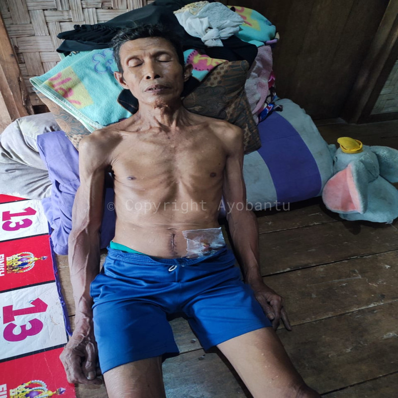 Urgent bantu pak mugni lawan kanker usus stadium 4