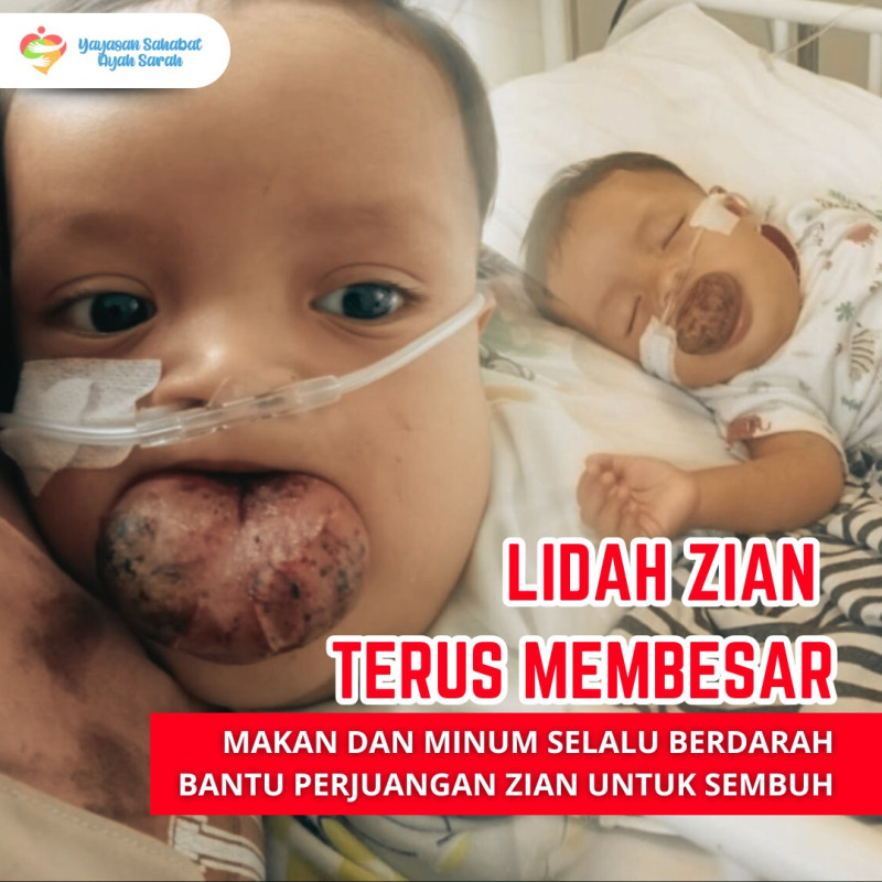 Lidah Terus Membesar &amp; Berdarah, Bantu Zian Sembuh