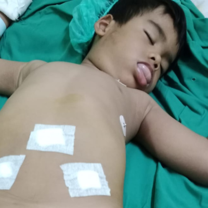 Lidah Menjulur Keluar Bantu Anak Tukang Panggul Sembuh!