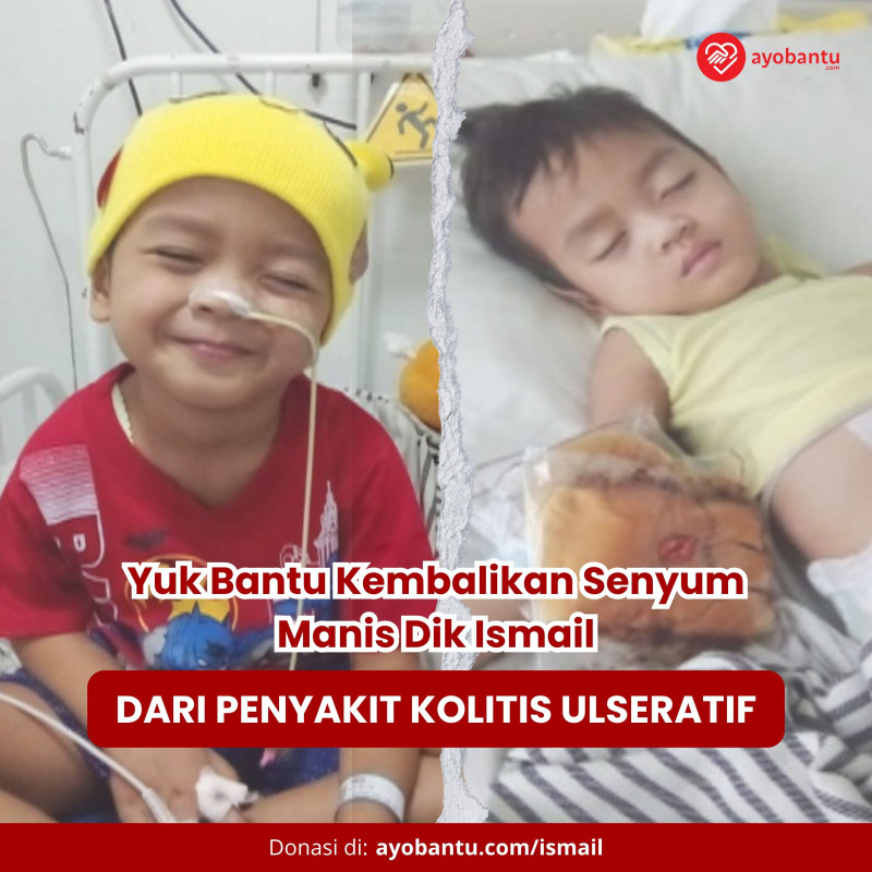 Bantu Ismail Sembuh dari Kolitis Kronis