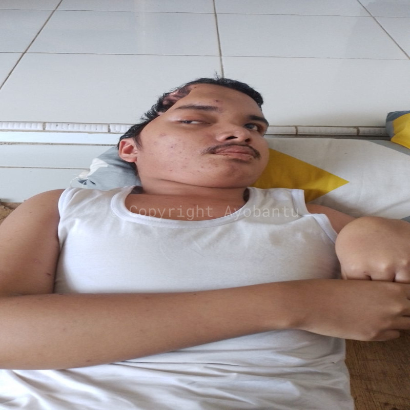 Fajah Masih Terus Bertahan denan Sebelah Tempurung Kepala, Bantu Perjuangan Fajah