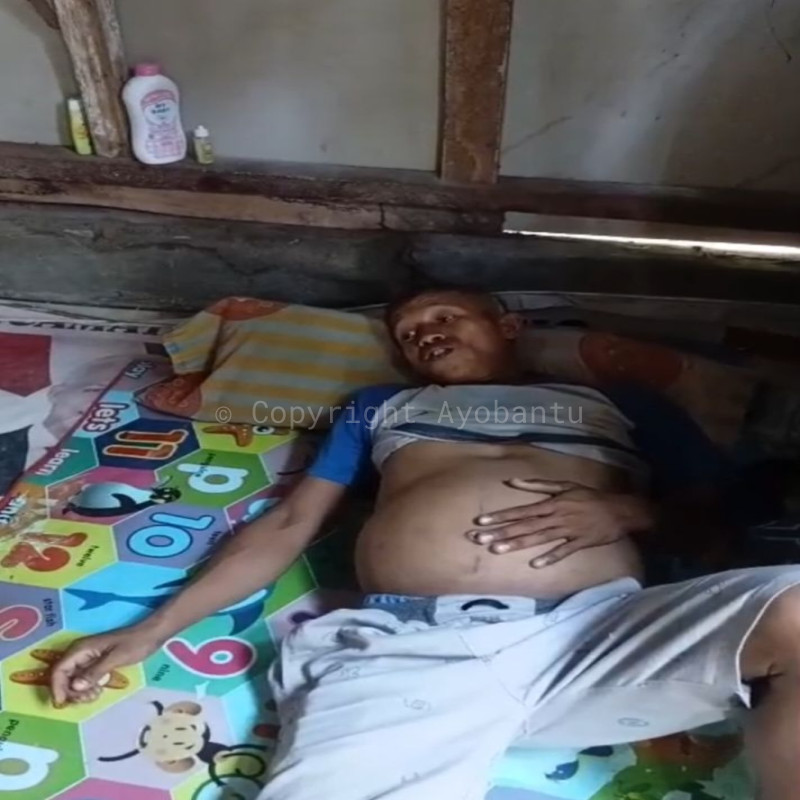 bantu ajon melawan penyakit tumor