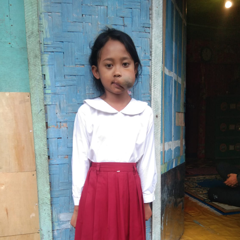 Trisabila dan Harapan Sembuhnya