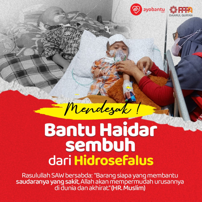 URGENT! Kanker Otak dan Hidrosefalus, Haidar Butuh Pertolonganmu