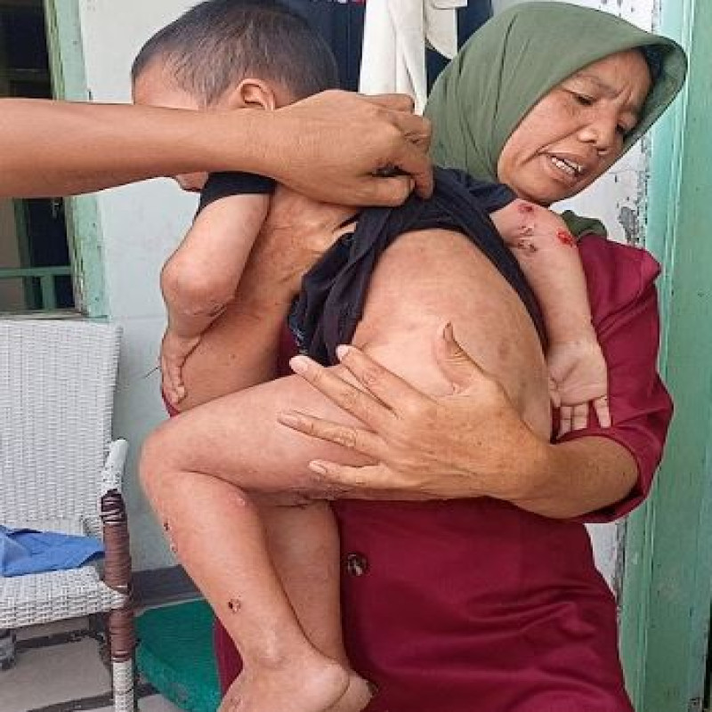 Kak, Penyakit Kulit Langka Serang Tubuh Mungilku, Bantu Dzikri Segera Berobat!