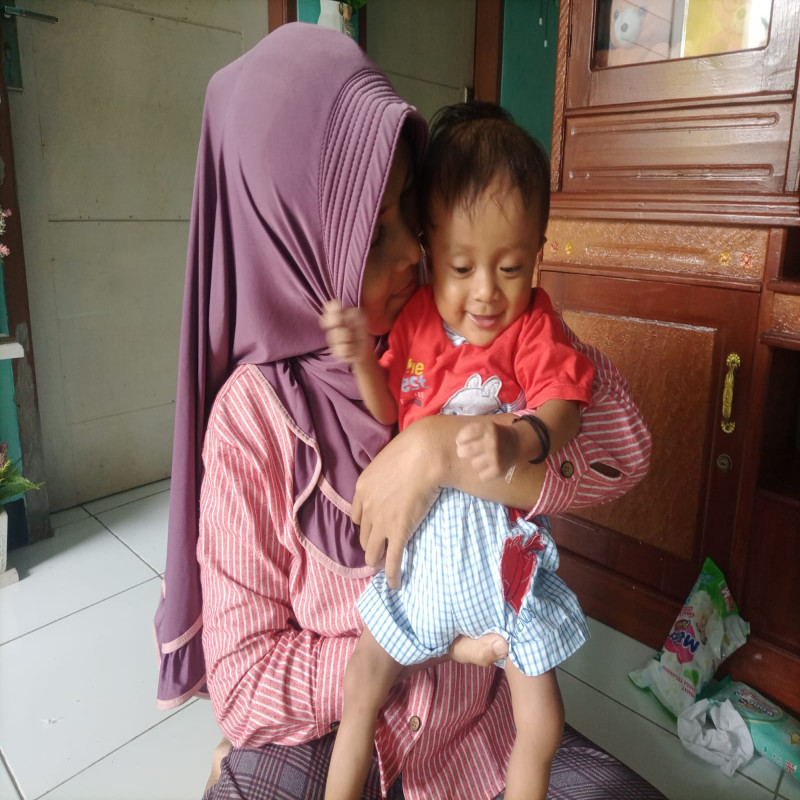 Bantu Dik Akbar (8 Bulan) Sembuh Melawan Penyakit Sejak Lahirnya.