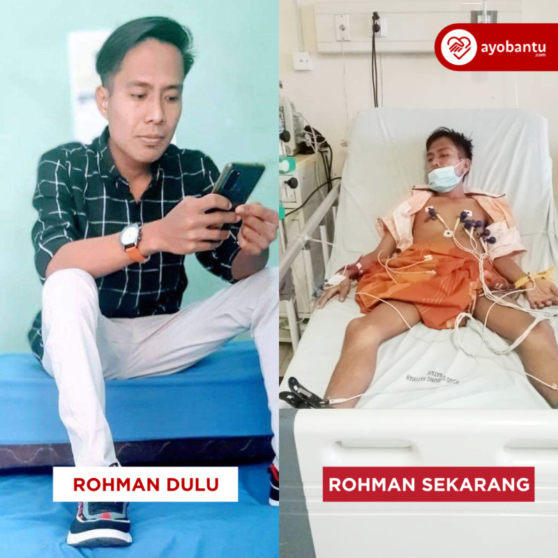 Alami Gagal Jantung, Rohman Butuh Operasi ke 2 di Jakarta