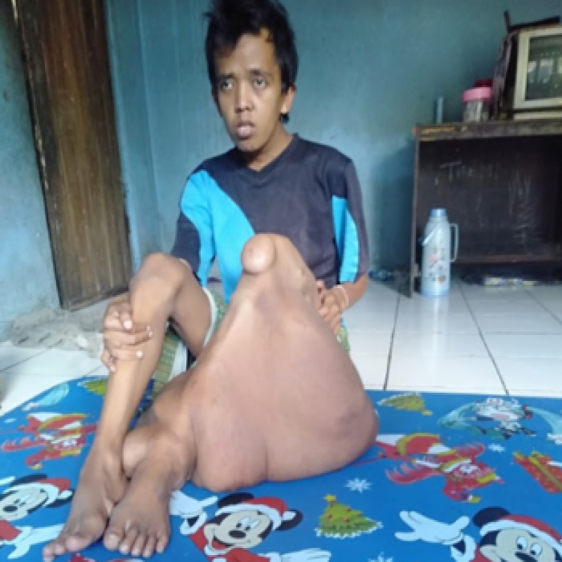Sudah 16 tahun lamanya, Wahyu (24 tahun) dengan sabar menanti kesembuhannya.