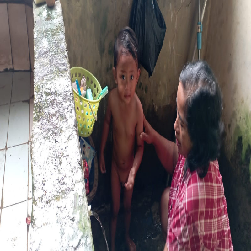 Ditinggal ibu saat melahirkan, Bilal idap penyakit Hernia