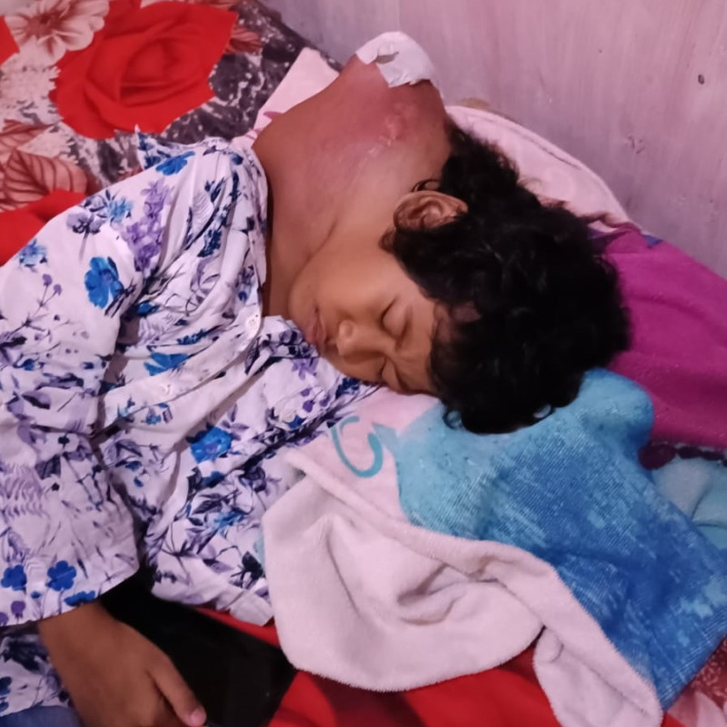 Darurat! Tumor Ganas Semakin Membesar, Aisyah Butuh Operasi Segera.