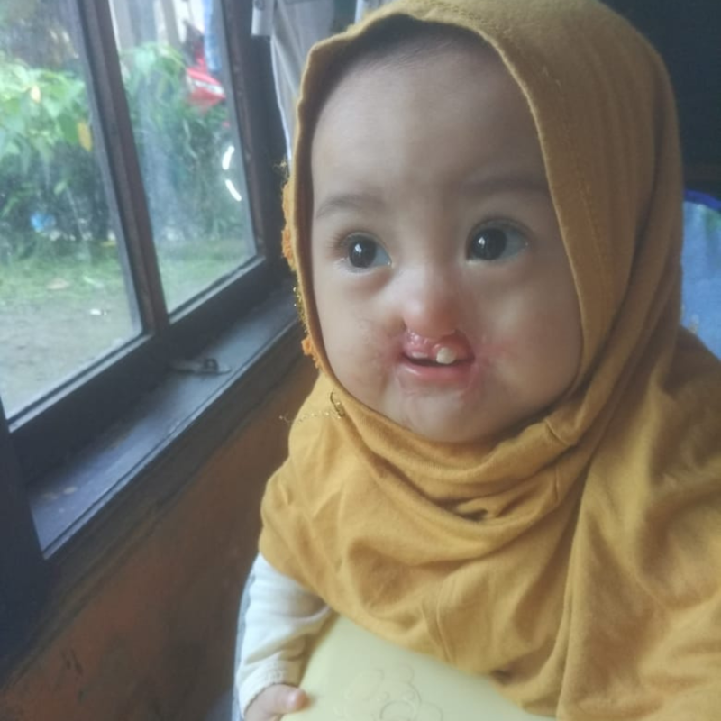 Bantu Pengobatan Rumaisha Sampai Sembuh