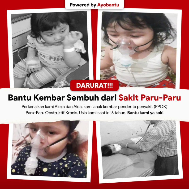 Bantu Kembar Sembuh dari Sakit Paru-Paru