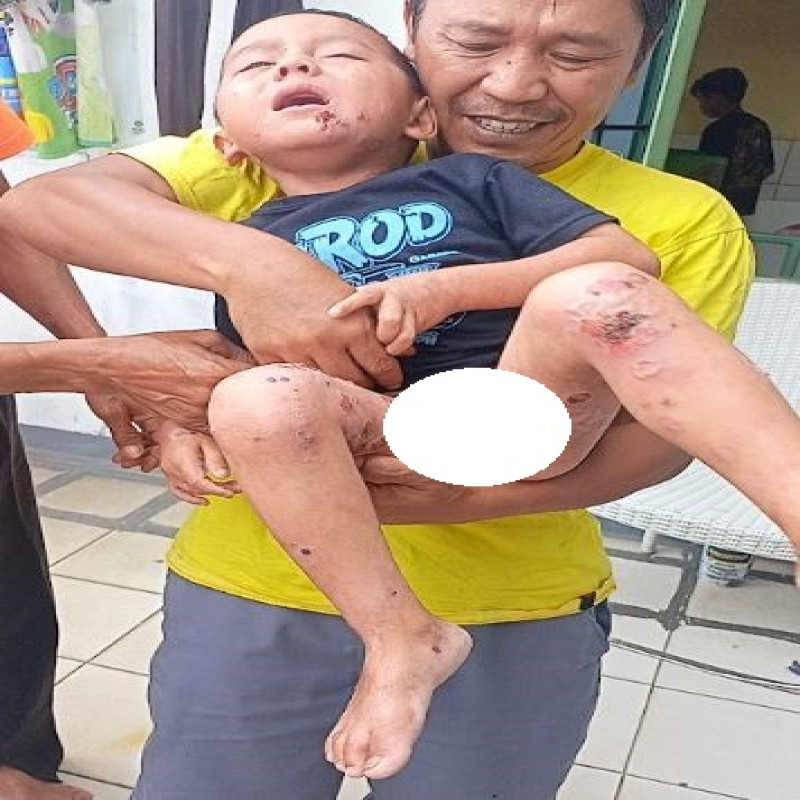 Kak, Penyakit Kulit Langka Serang Tubuh Mungilku, Bantu Dzikri Segera Berobat!