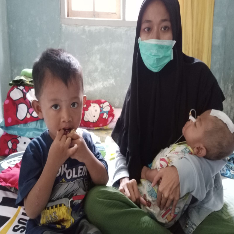 Urgent!!! Bayi fatih harus segera operasi kepala