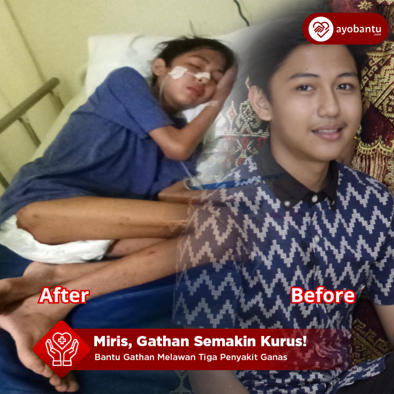 Lawan Tiga Penyakit Ganas Bantu Gathan Untuk Sembuh