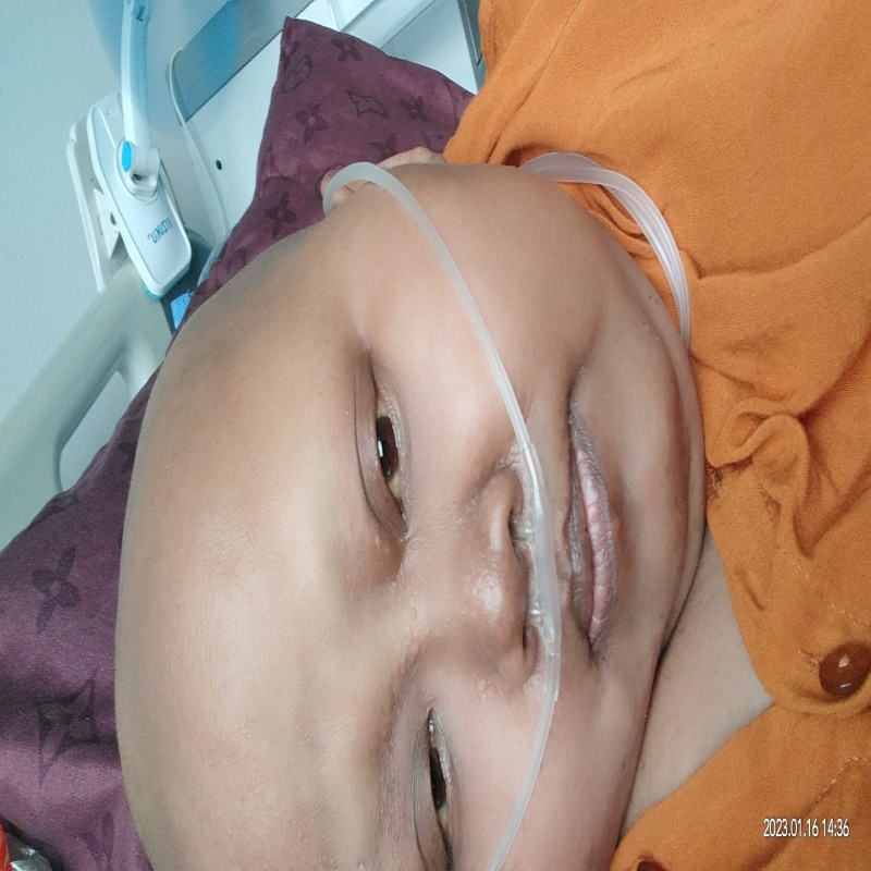 Bantu Bu Tri untuk Sembuh dari Kanker Payudara yang Sudah Menyerang Tulang & Paru-parunya!