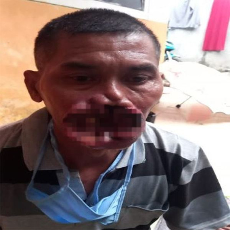 Kanker Pudarkan Senyuman Pak Enjat, Tolong! Bantu Guruku Segera Berobat.