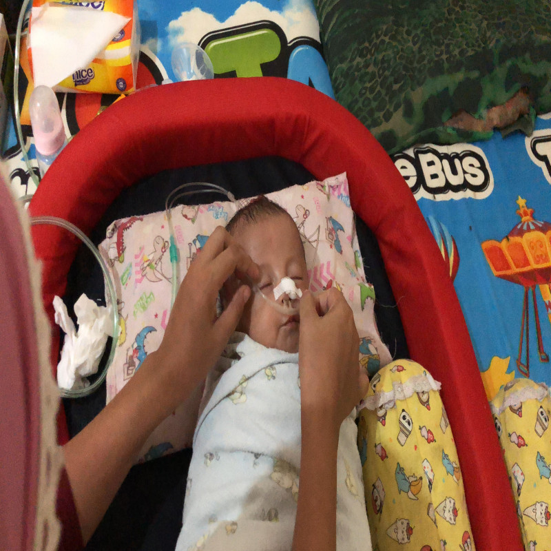 Bantu Abdullah, Bayi 4Th OPERASI PARU-PARU