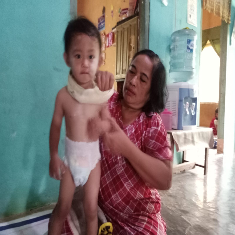 Ditinggal ibu saat melahirkan, Bilal idap penyakit Hernia