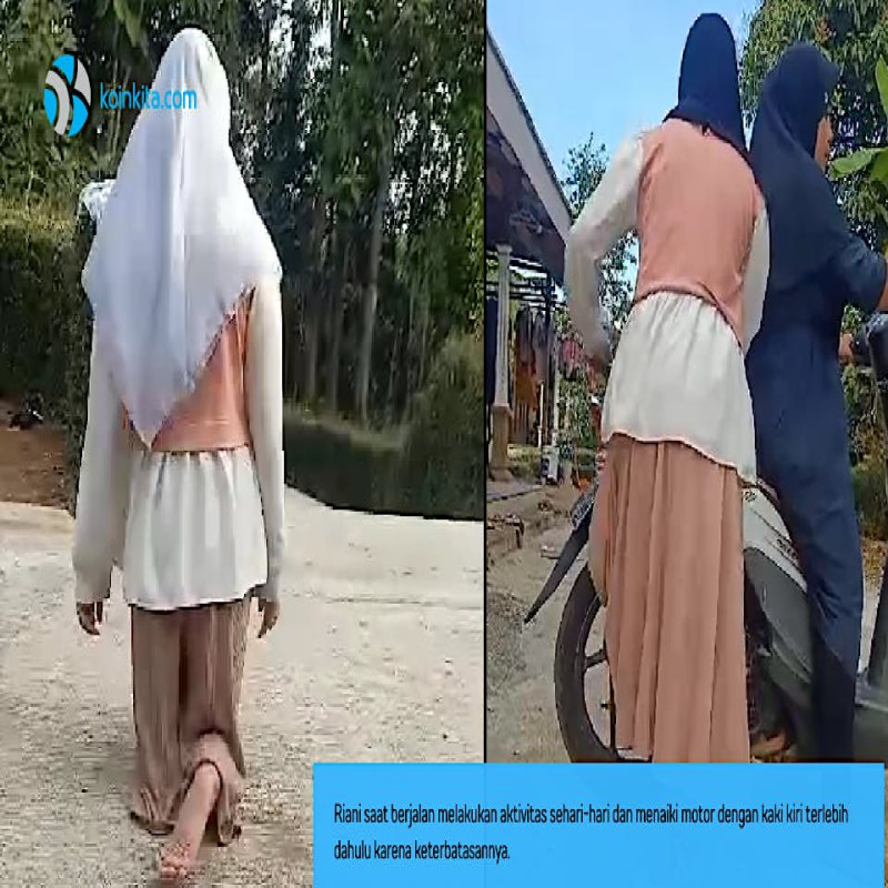Patungan Beli Kaki Palsu Untuk Riani
