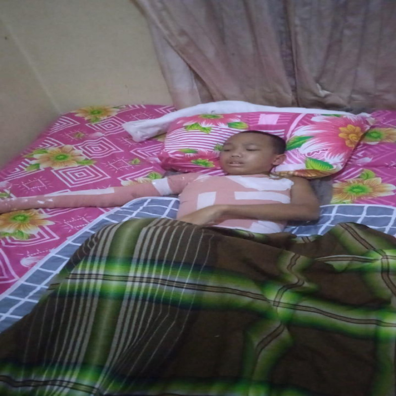 Miris!! Api Menyambar Tubuh Santri. Yuk Bantu Sembuhkan Luka Bakarnya